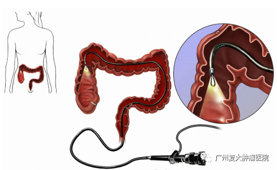 ny28_121584.png ny28_121584.png