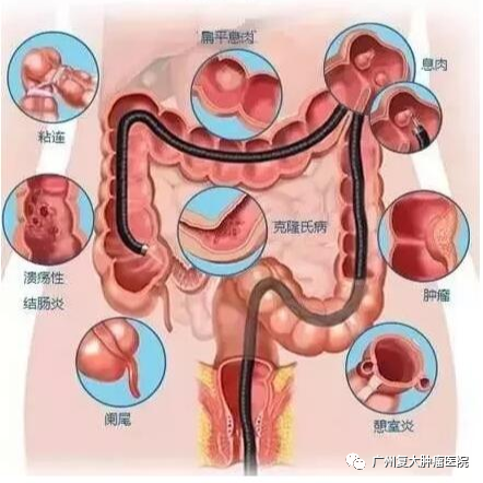 ny06_196380.png bb5.png