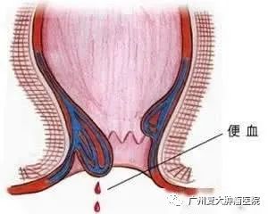 ny06_435109.jpg bb3.jpg